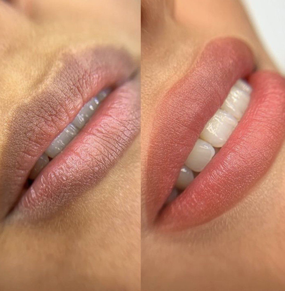 El detalle de tus labios · Doctor Cejas RD
