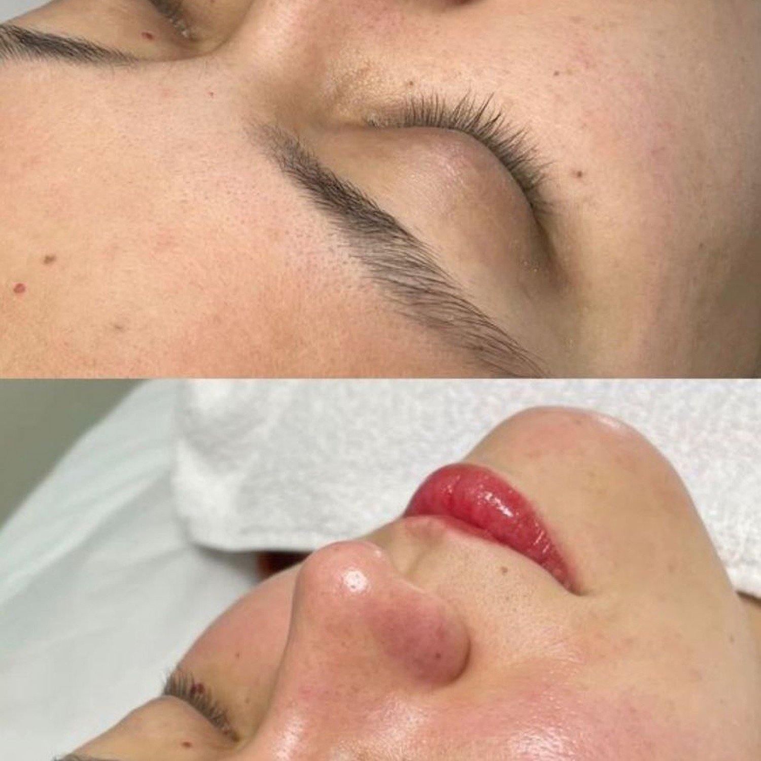 Faciales vitaminados