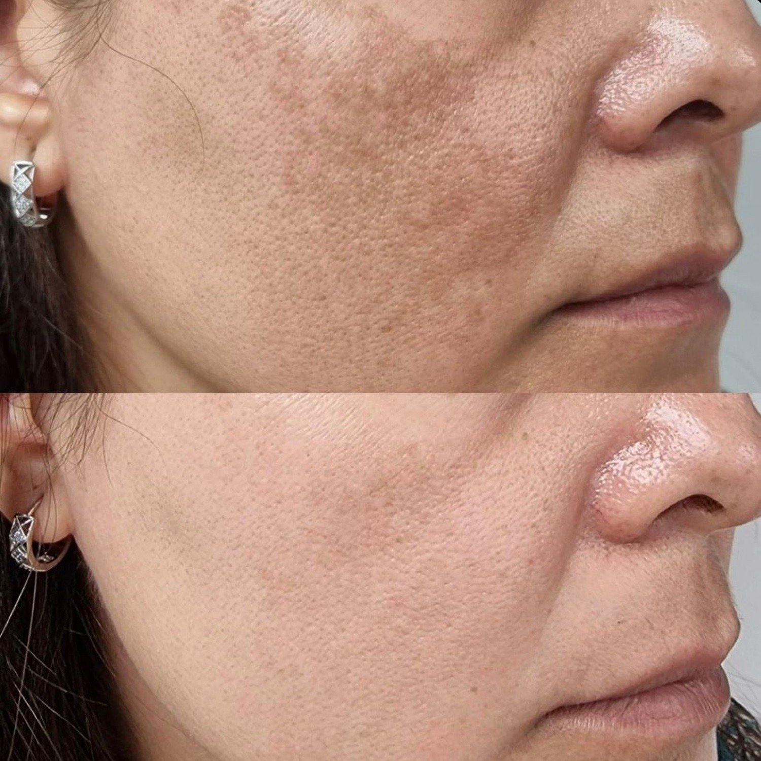 Hollywood Peeling