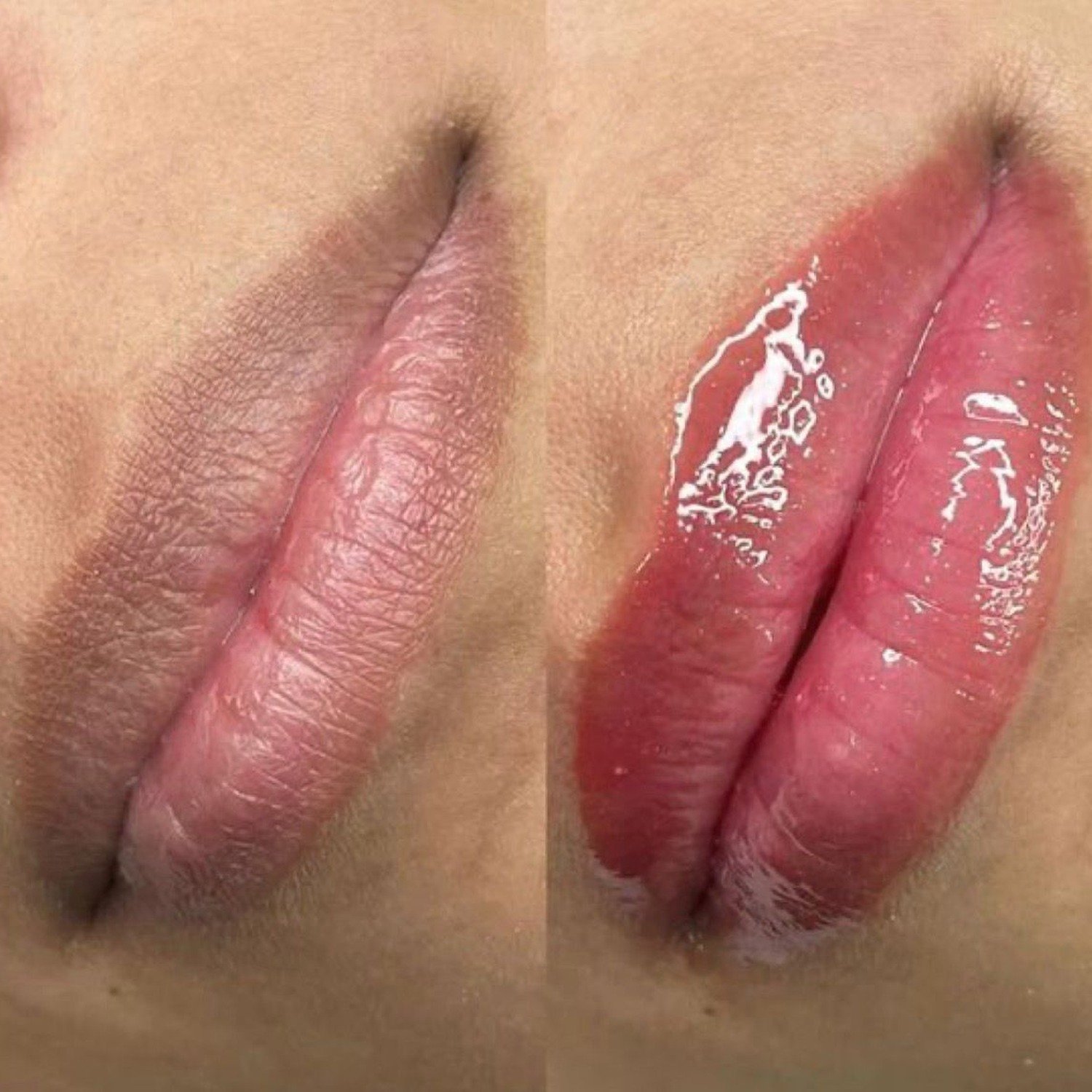 Hidra Lips